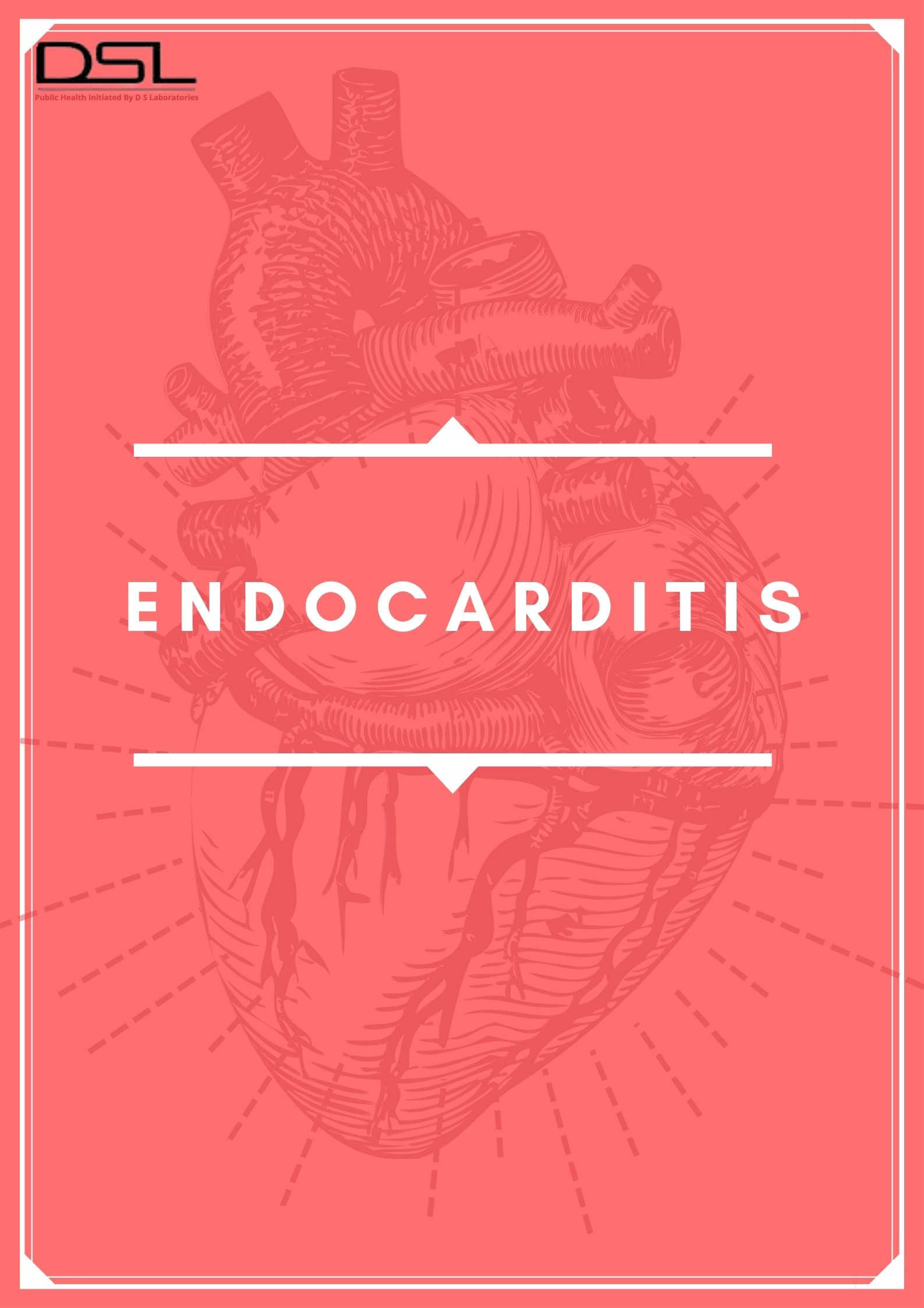 ENDOCARDITIS